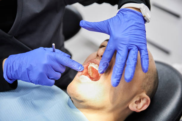 Reliable CA Emergency Dental Service Solutions